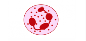 Neutropenia