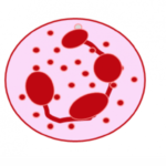 Neutropenia: o que ocorre quando faltam células da sua primeira linha de defesa?