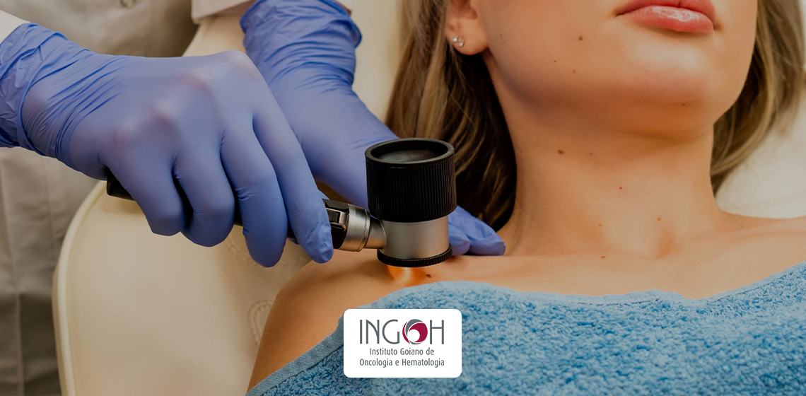 exames de rastreamento para câncer de pele