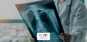 o que é câncer de pulmão