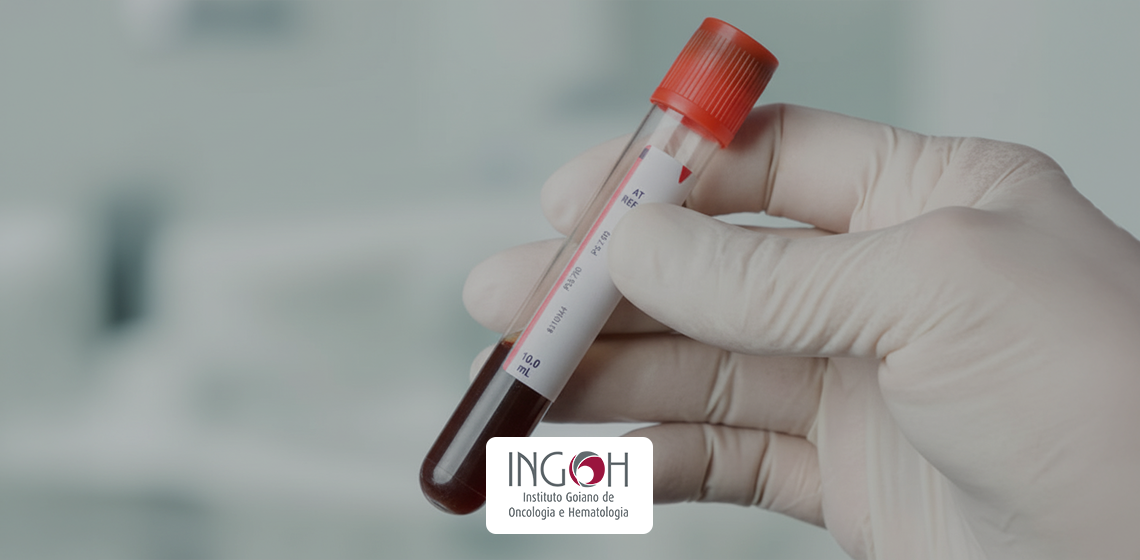 tratamento de leucemia